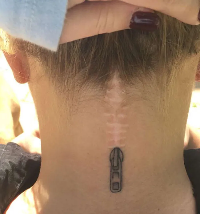211 Amazing Tattoos That Turn Scars Into Works Of Art