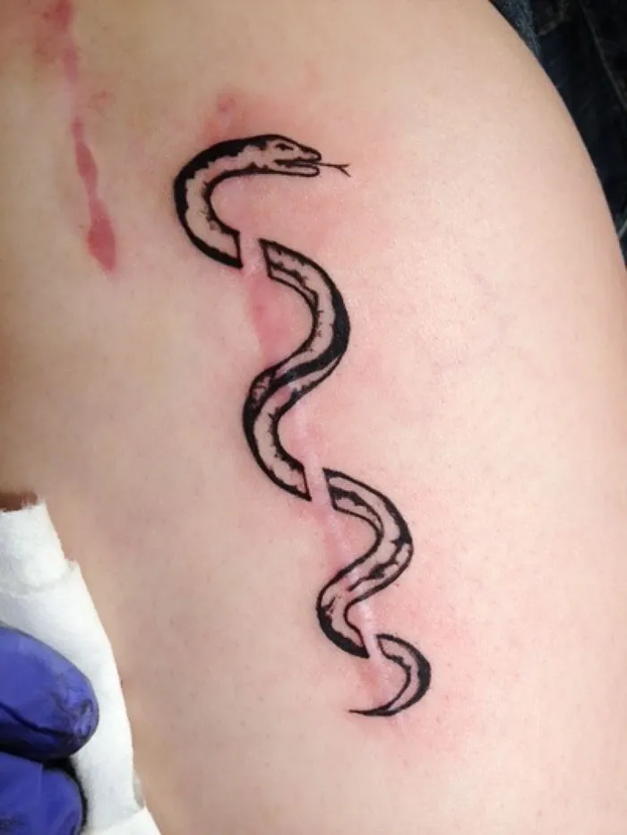 Snake tattoo artistically incorporates scar, transforming it into art.