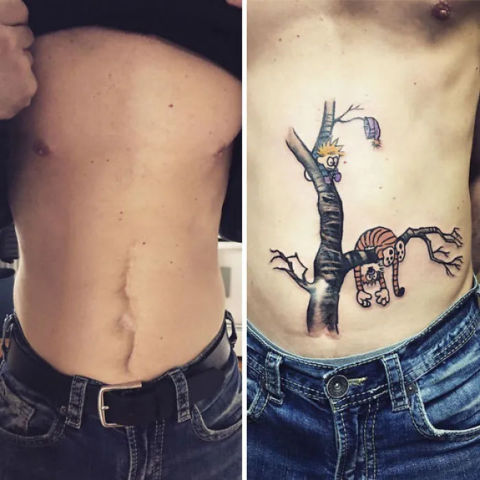 211 Amazing Tattoos That Turn Scars Into Works Of Art