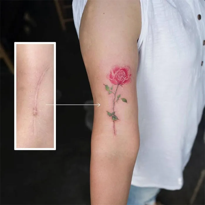 211 Amazing Tattoos That Turn Scars Into Works Of Art