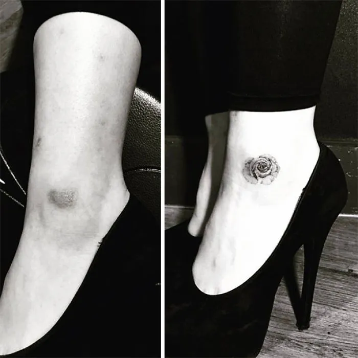 10+ Increíbles tatuajes que convierten cicatrices en obras de arte