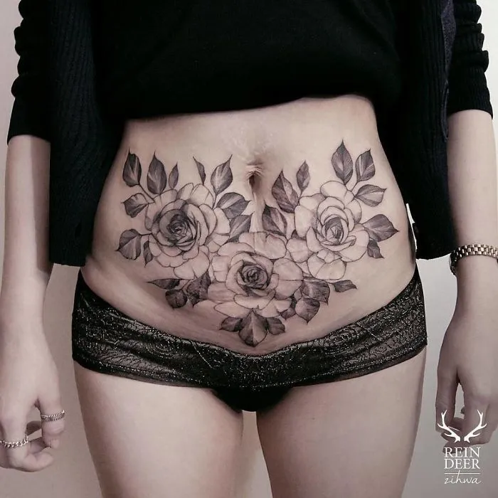 Floral tattoo on lower abdomen creatively transforms scars into art.