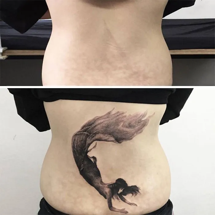 Tattoo art transforming scars on lower back into a detailed mermaid design, enhancing appearance with creativity.