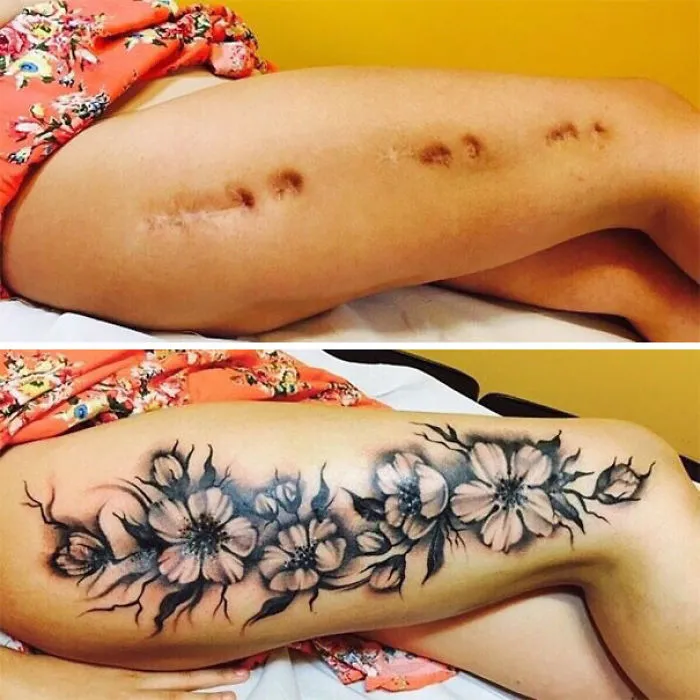 211 Amazing Tattoos That Turn Scars Into Works Of Art