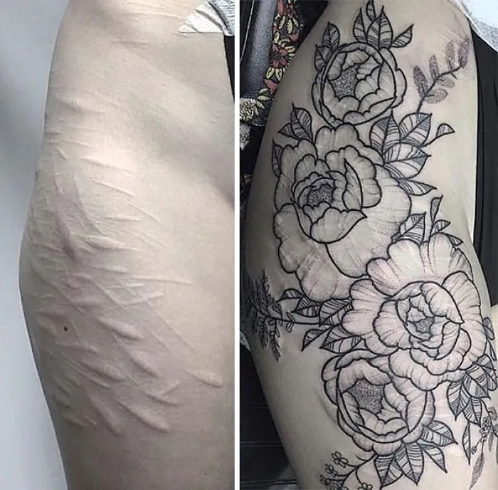Tattoo transforms scars into floral artwork on the arm, showcasing creative scar cover-up.
