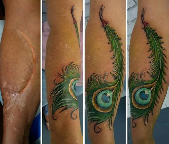 211 Amazing Tattoos That Turn Scars Into Works Of Art