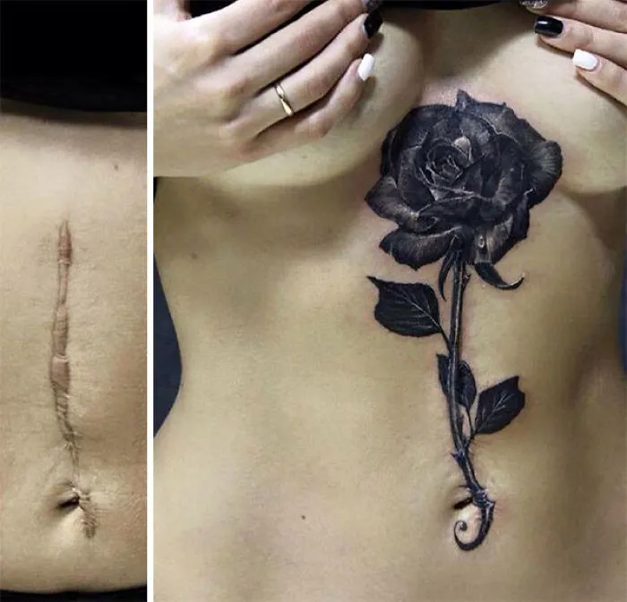 211 Amazing Tattoos That Turn Scars Into Works Of Art