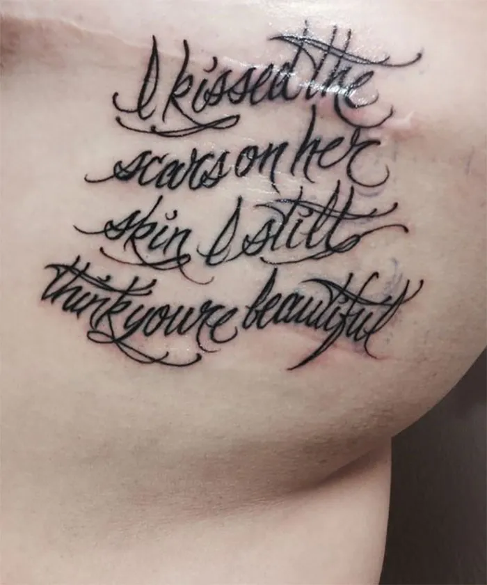 Inspirational tattoo covering scar reading "I kissed the scars on her skin, I still think you're beautiful."