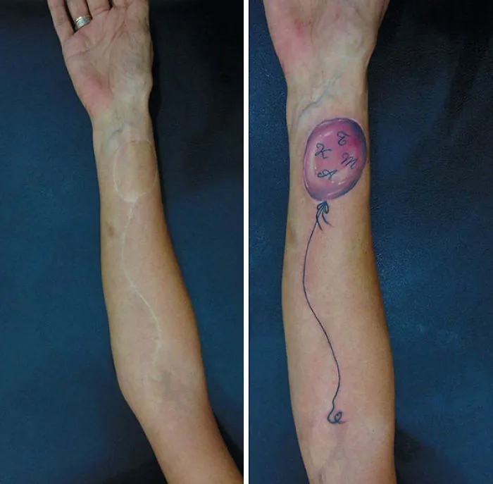 Tattoo covering scar with a balloon design on forearm, showcasing amazing art transformation.