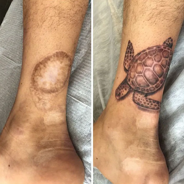 211 Amazing Tattoos That Turn Scars Into Works Of Art