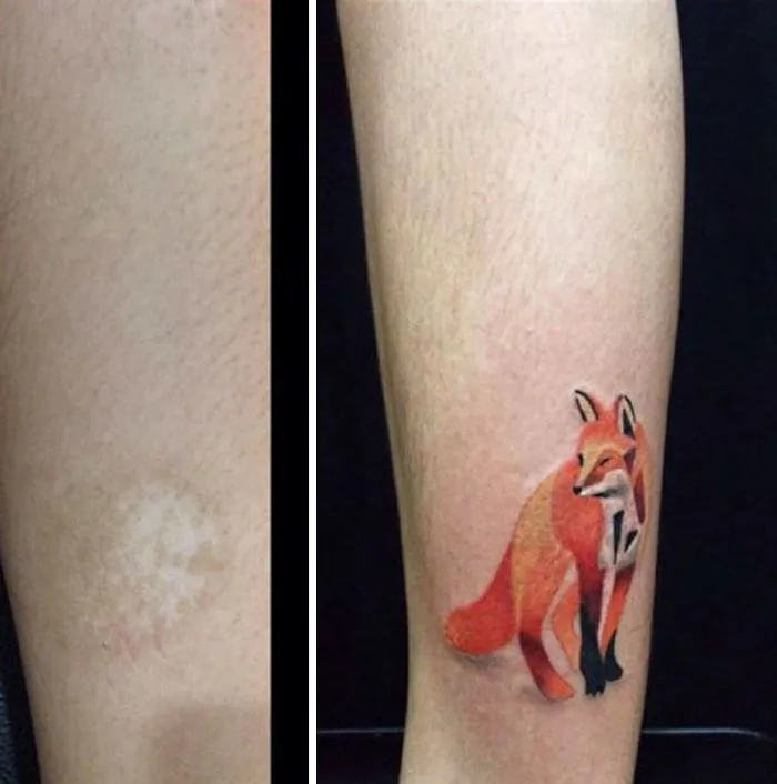 10+ Increíbles tatuajes que convierten cicatrices en obras de arte