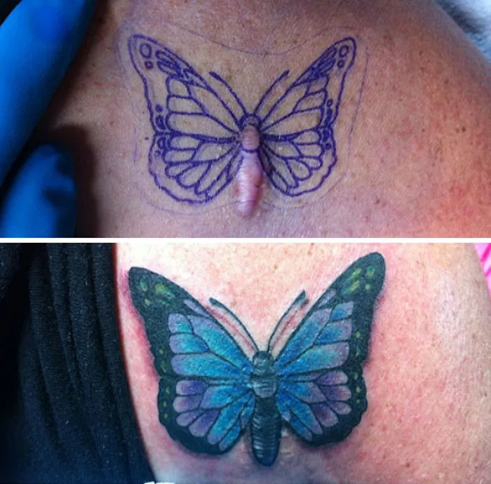 Butterfly tattoo transforms scar into art, with vibrant blue and purple hues enhancing the design.