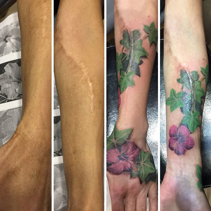 Scar on arm transformed with vibrant floral tattoos, showcasing amazing scar cover-up artistry.