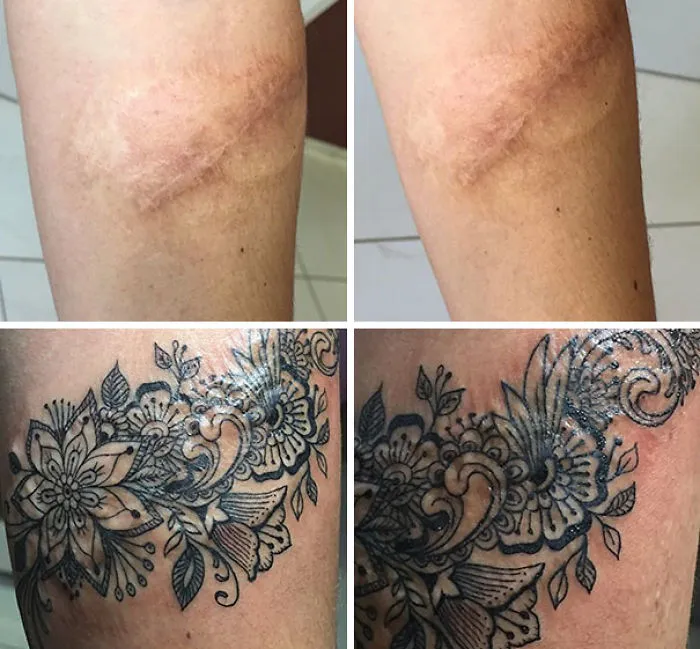 Floral tattoo design transforming arm scars into art, showcasing amazing tattoo artistry.