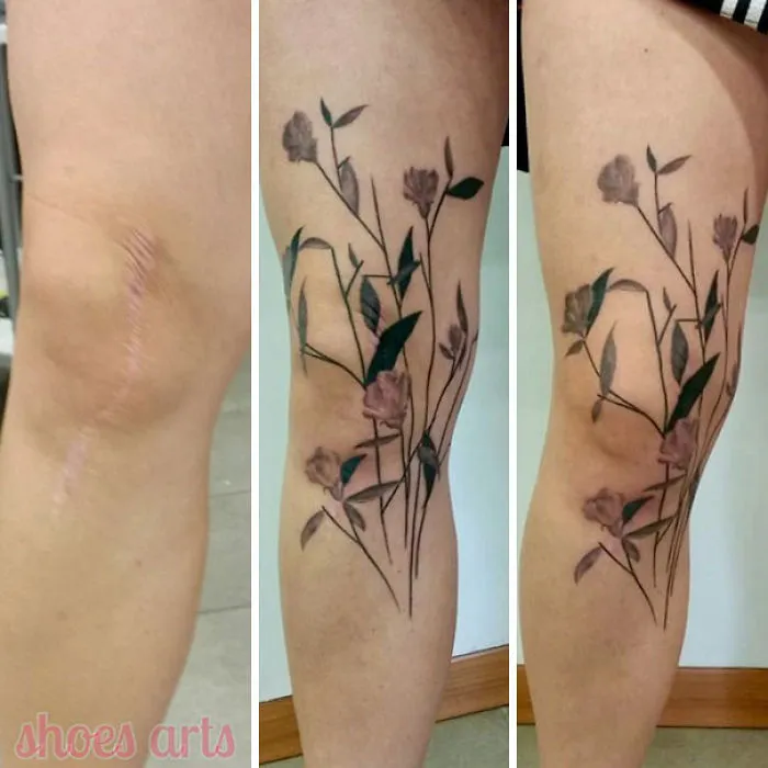 Tattoo covers knee scar with floral design, transforming the scar into a beautiful work of art.