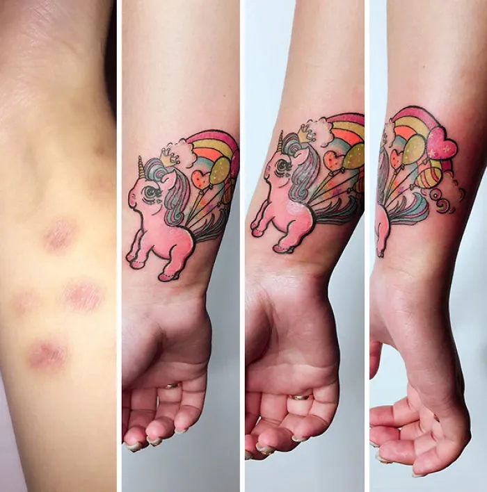 Unicorn tattoo covering scars, transforming them into artistic expressions on the arm.