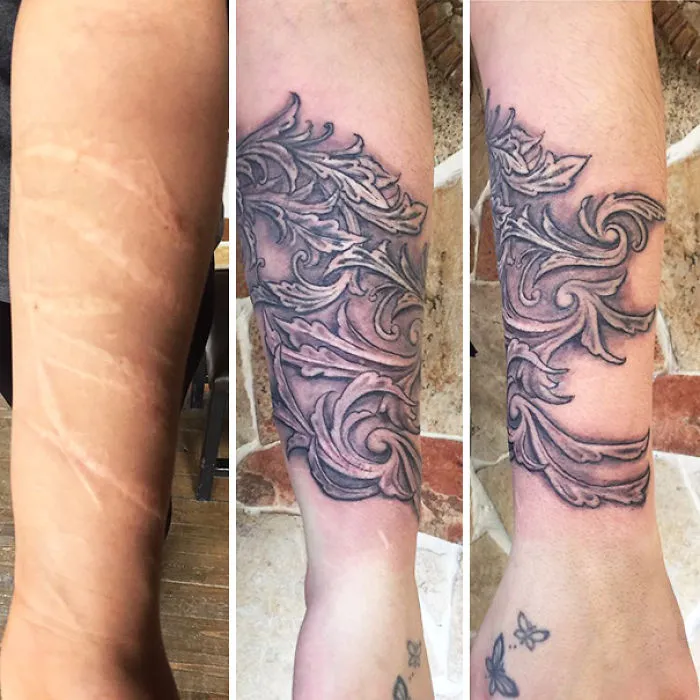 Tattoo transforming forearm scar into intricate artwork with swirling patterns.