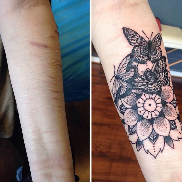 Tattoo art transforming scars into butterflies and flowers on an arm.
