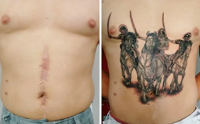 Tattoo transforming a scar into an artistic scene of three horsemen, showcasing creativity and transformation.
