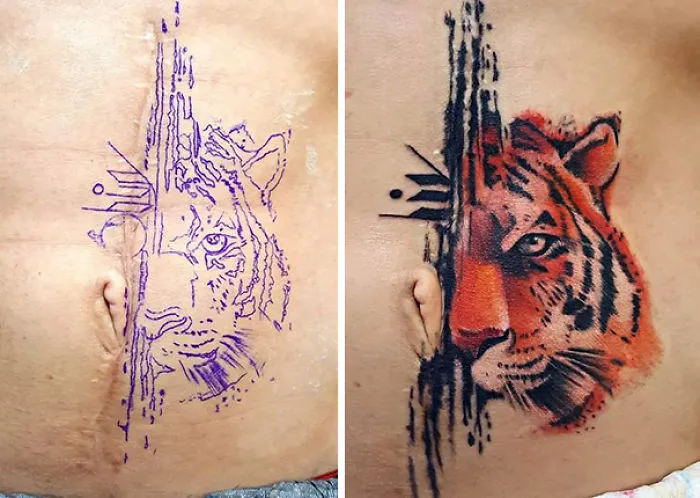 Tattoo of a tiger transforming a scar into artwork on skin.