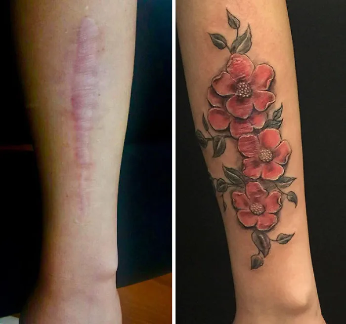 Scar transformed with a floral tattoo into amazing art, showing before and after on an arm.