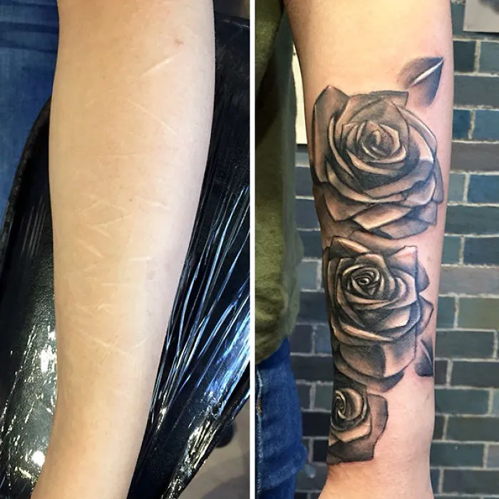 Before and after image of arm scars transformed into floral tattoos, showcasing how tattoos turn scars into art.