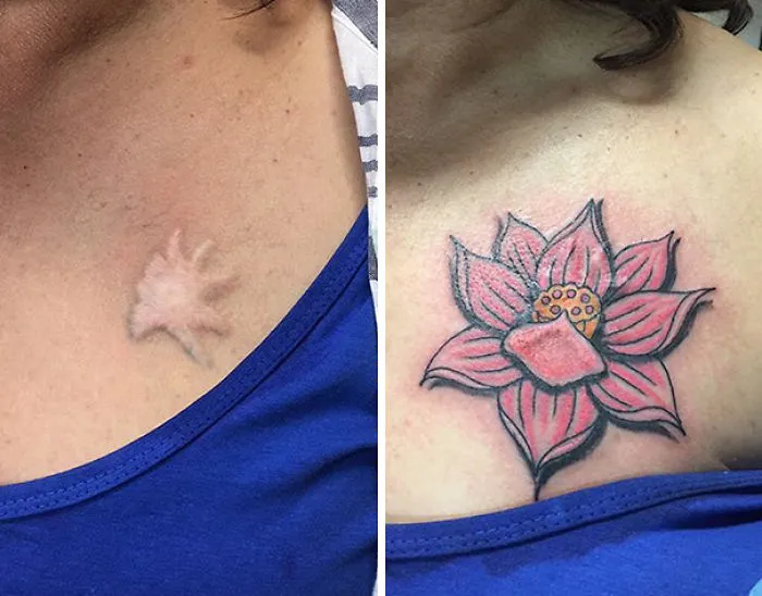 Tattoo transforming scar into a vibrant pink flower on shoulder.