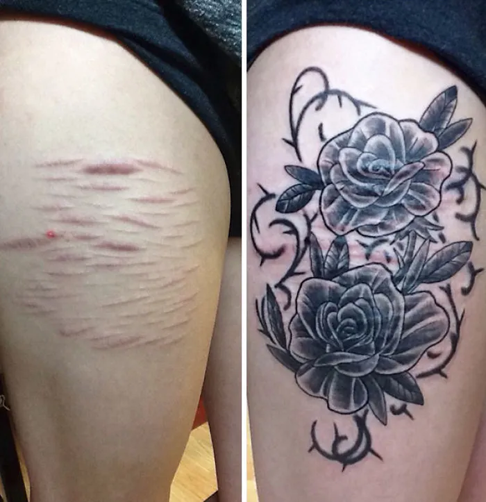 Tattoo transforming scars into floral art on a leg, showcasing creative scar cover-up work.