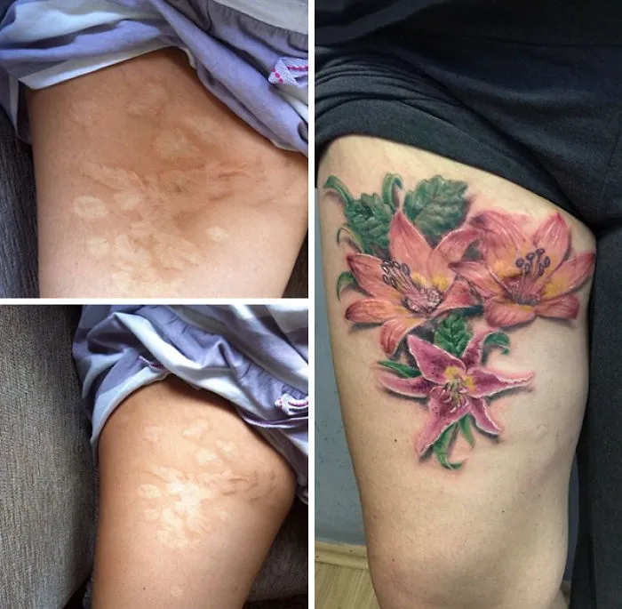 Floral tattoo transforming scars into art on a person's thigh, showcasing vibrant lilies.