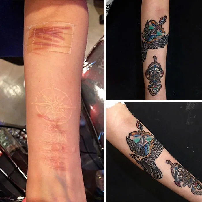 Scars transformed into art with vibrant tattoos featuring colorful designs on an arm, showcasing amazing tattoo creativity.