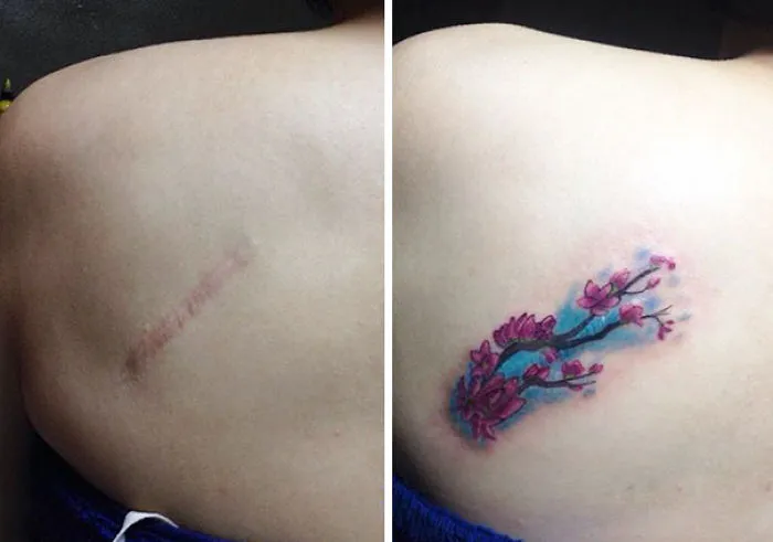 Tattoo covers a scar on a shoulder, featuring a floral design, transforming scars into works of art.