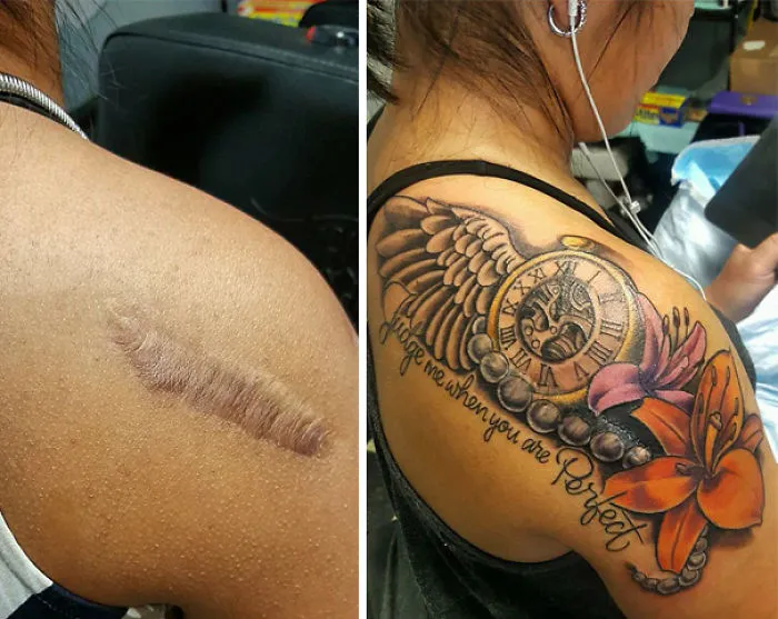Tattoo transforms a shoulder scar into art featuring a clock, wings, and flowers.