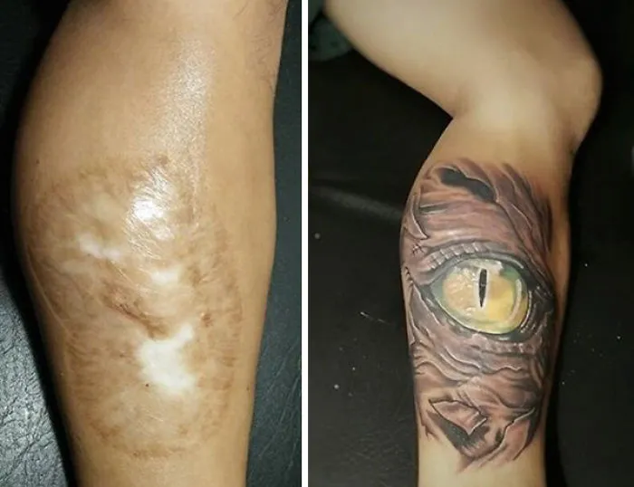 Tattoo art transforming a scar into a lifelike eye design on a leg.