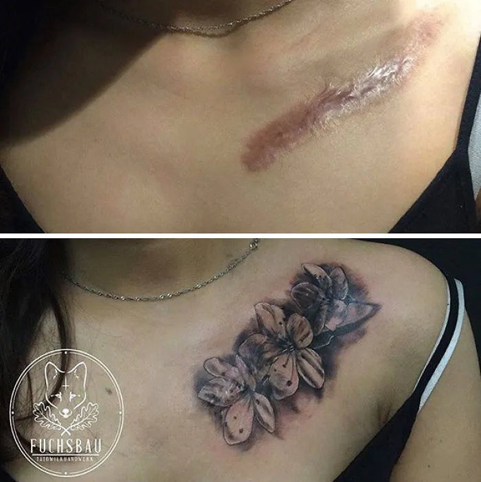 Tattoo art transforming a chest scar into floral design, showcasing amazing creative transformation.