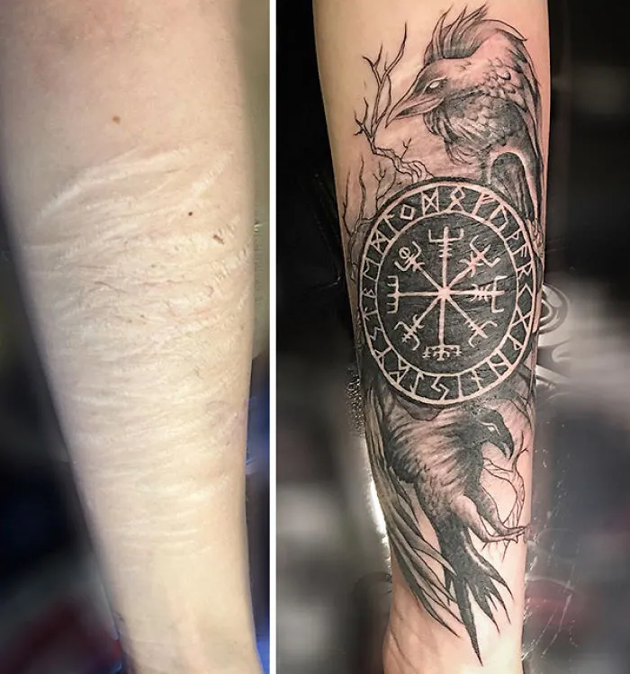 211 Amazing Tattoos That Turn Scars Into Works Of Art