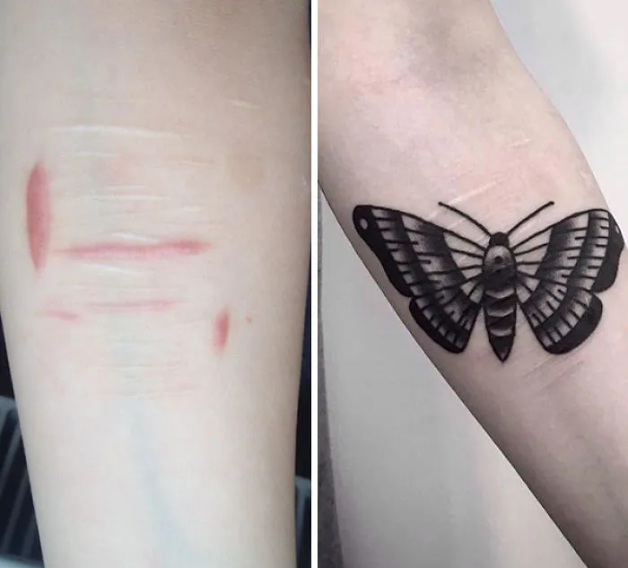 Butterfly tattoo transforms scar into art on forearm.