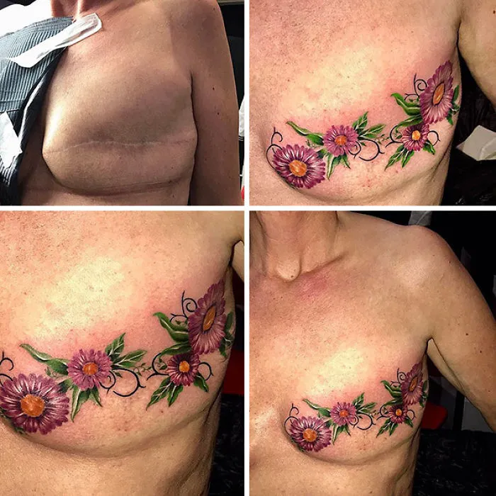 10+ Increíbles tatuajes que convierten cicatrices en obras de arte