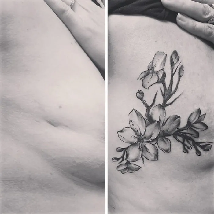 Before and after image of a scar covered with an artistic floral tattoo transformation.
