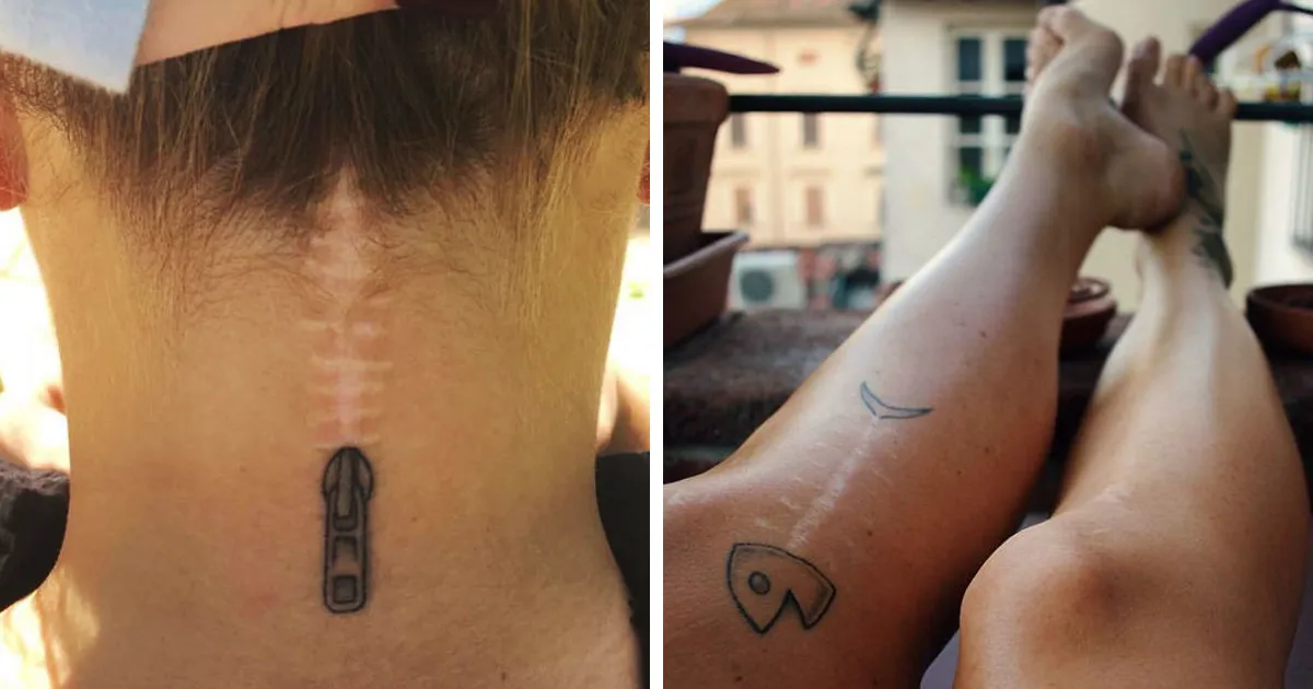 10+ Increíbles tatuajes que convierten cicatrices en obras de arte