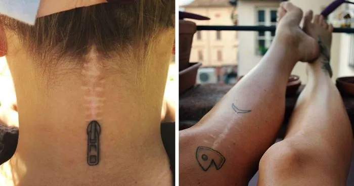 211 Amazing Tattoos That Turn Scars Into Works Of Art