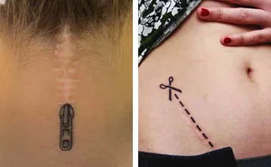 211 Amazing Tattoos That Turn Scars Into Works Of Art