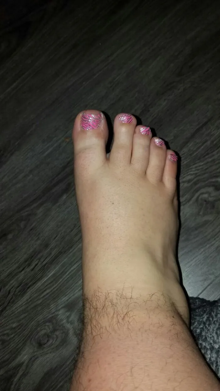 Close-up of a big toe with pink, glittery nail polish, capturing a funny moment in marriage.