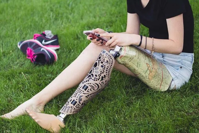 Company Develops Customized Covers To Transform Mechanical Prostheses Into Stylish Accessories