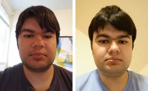 My Attempt To Become The World's First Person To Be Cured From Autism Through Plastic Surgery