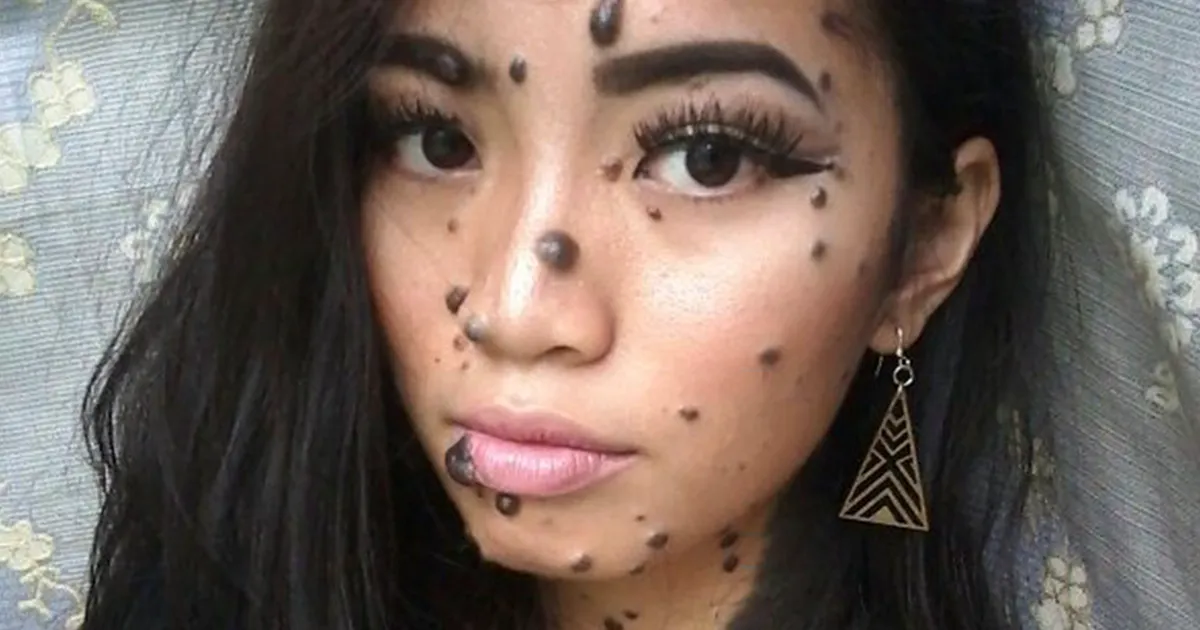A esta mujer la llamaban monstruo por estar cubierta de verrugas de los pies a la cabeza, pero ahora podría ser la próxima Miss Universo