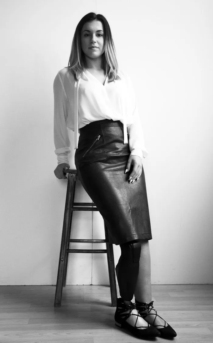 Vicky. B Stunning Model & Amputee