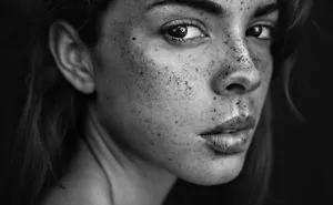 Another Freckle Project.