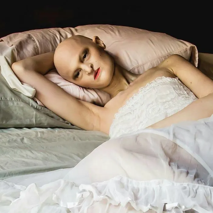 Meet Melanie Gaydos, 28-Year-Old Model With A Rare Genetic Disorder Who Broke All Fashion Stereotypes