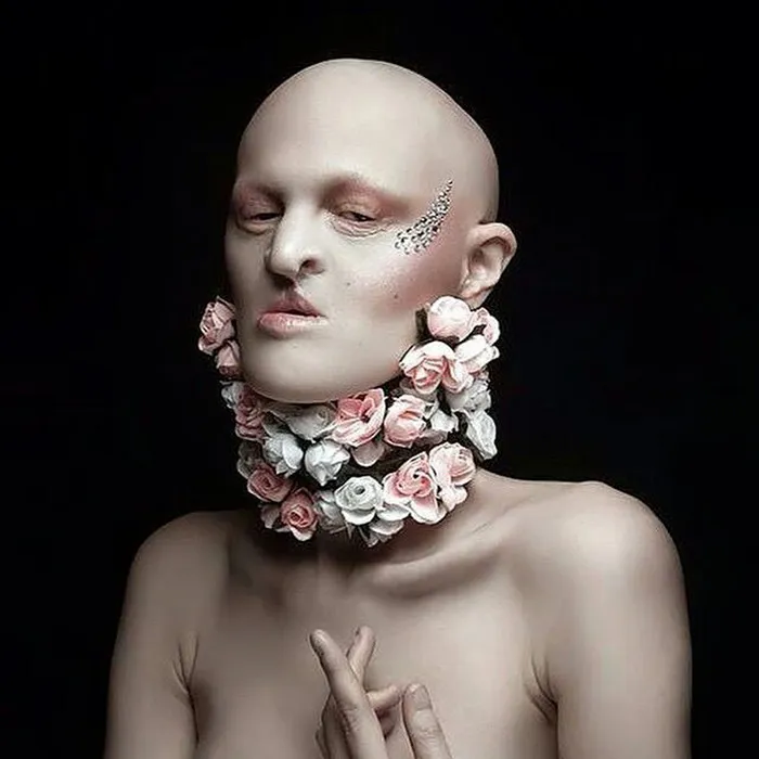 Meet Melanie Gaydos, 28-Year-Old Model With A Rare Genetic Disorder Who Broke All Fashion Stereotypes