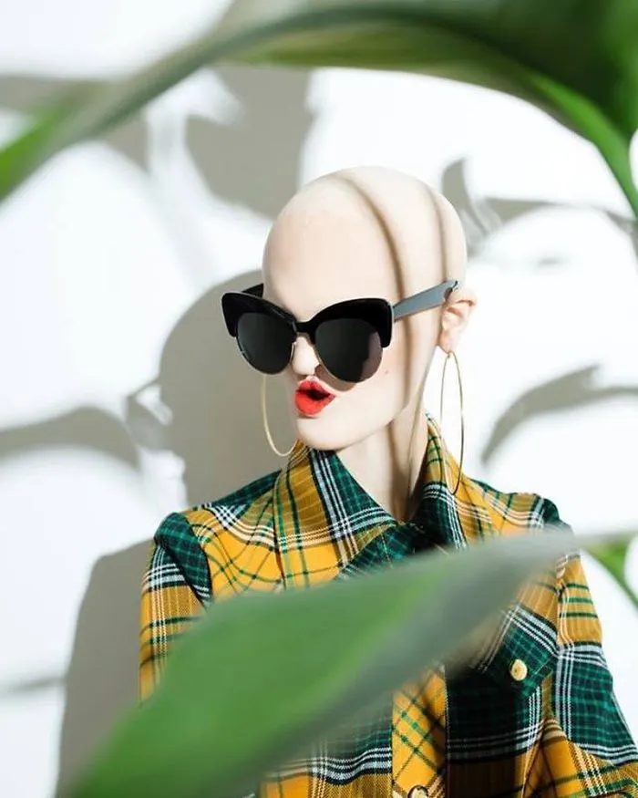 Meet Melanie Gaydos, 28-Year-Old Model With A Rare Genetic Disorder Who Broke All Fashion Stereotypes